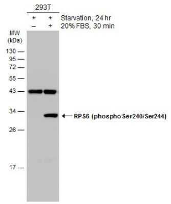 Western Blot: Ribosomal Protein S6/RPS6 [p Ser240, p Ser244] Antibody [NBP3-13315]